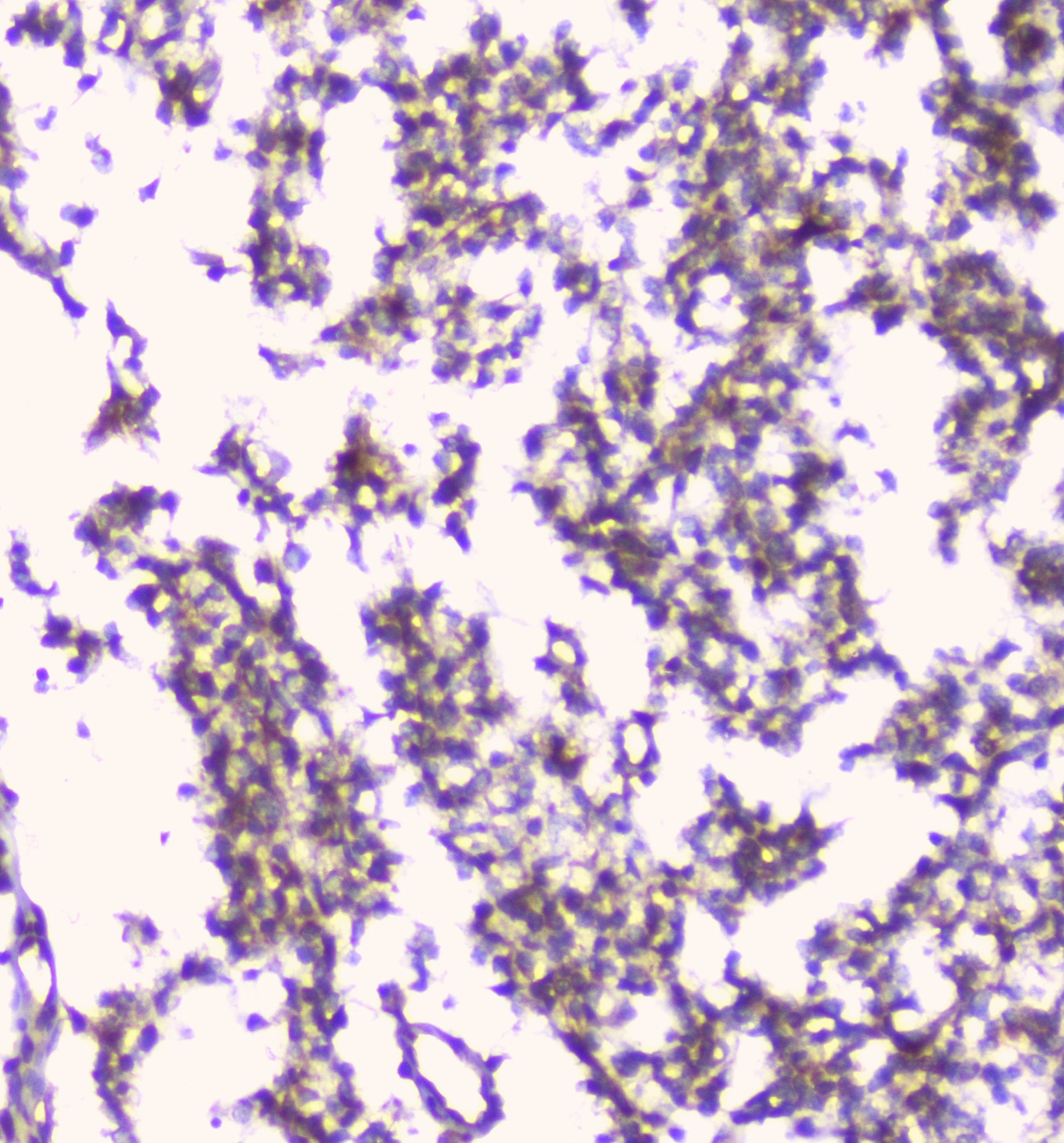 ERGIC-53 / LMAN1 Antibody