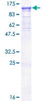 Human PLCD4 Protein (Recombinant GST)