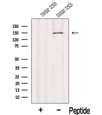 IFT122 / WDR10 Antibody