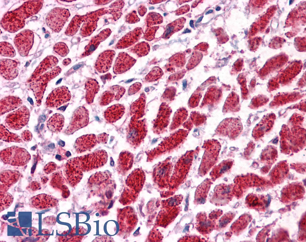 SNF8 / EAP30 Antibody (N-Terminus)