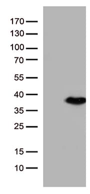ENOPH1 / MASA Antibody (clone OTI4A8)