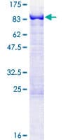 Human MTMR2 Protein (Recombinant GST)
