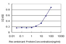 IHC-plus™ Monoclonal Mouse anti-Human UBE2D2 / UBCH5B Antibody (clone 4A1, IHC, WB)