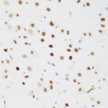 CSRNP1 / AXUD1 Antibody