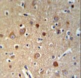 IHC-plus™ HSPA12A Antibody (aa398-427)
