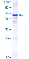 Human HRASLS5 Protein (Recombinant GST)