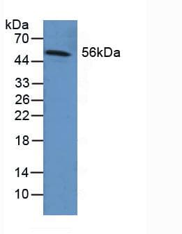 FGB / Fibrinogen Beta Chain Antibody (aa29-118)