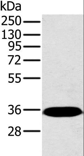 Polyclonal Rabbit anti-Human PP2Ac / PPP2CA Antibody (IHC, WB)