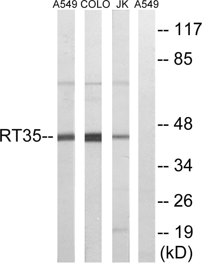 MRPS35 Antibody (aa211-260)