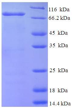 Human NDST1 Protein (Recombinant His-SUMO)