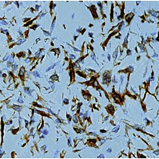 Vimentin Antibody (clone V9)