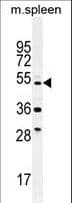 TTC23L / FLJ25439 Antibody (aa319-348)