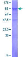 Human RAB3IP / RABIN3 Protein (Recombinant GST)
