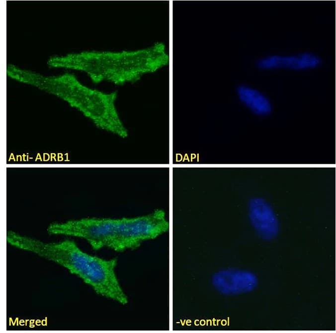 ADRB1 Antibody (aa202-214)