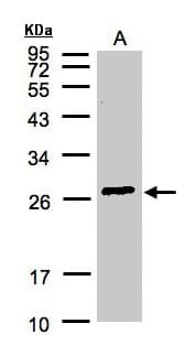 IHC-plus™ Polyclonal Rabbit anti-Human GSTA2 Antibody (aa1-196, IHC, WB)