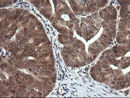 FAK / Focal Adhesion Kinase Antibody (clone OTI4G7)