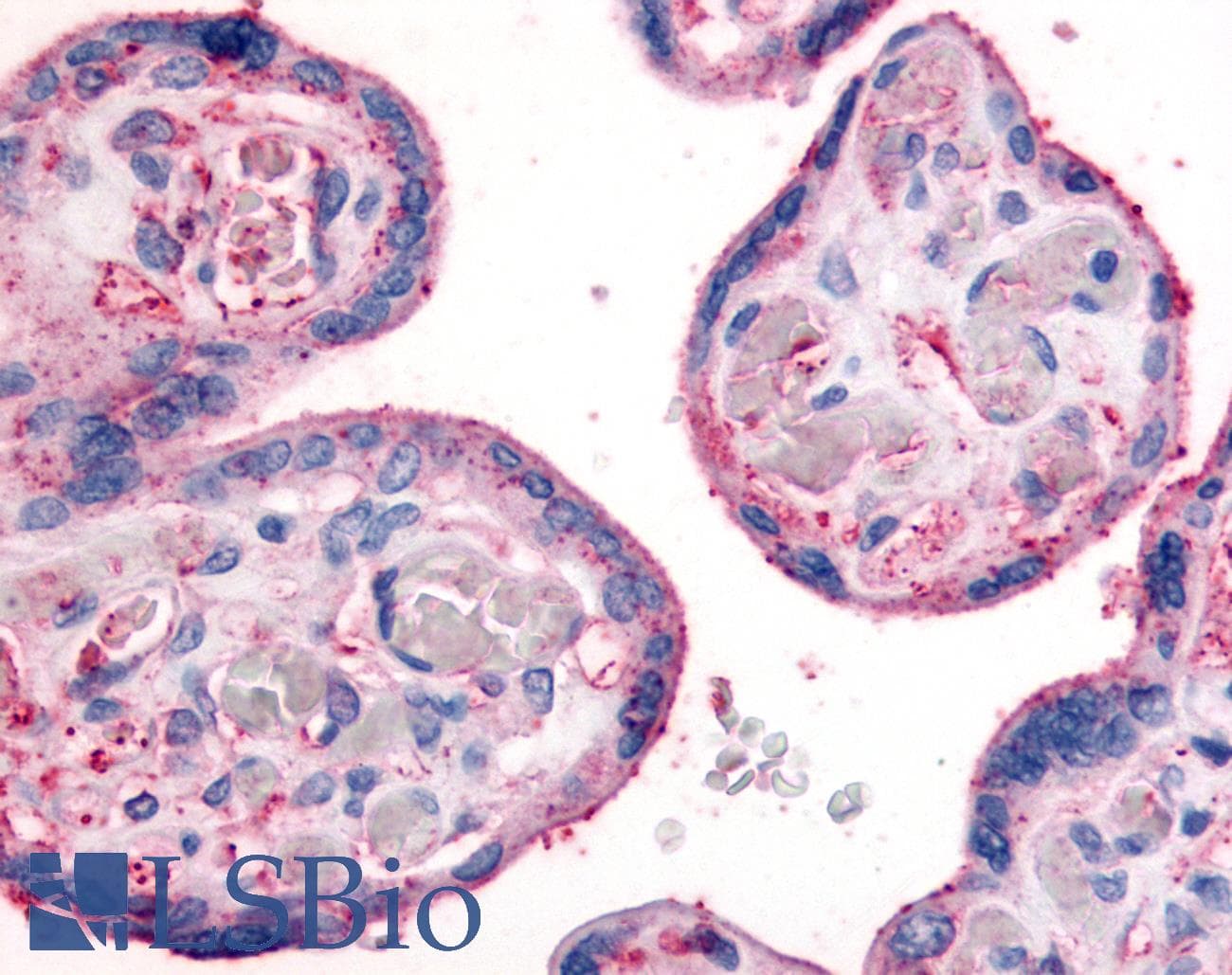 IHC-plus™ Polyclonal Rabbit anti-Human ITGB1 / Integrin Beta 1 / CD29 Antibody (Extracellular Domain, IHC)