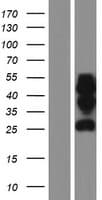 PRR5 Protein (Over-Expression Lysate Myc-DDK (Flag))
