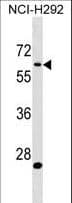 APBA3 / MINT3 Antibody (aa299-327)