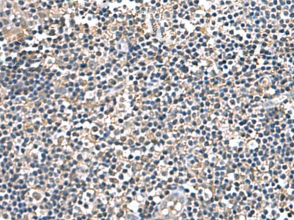 IP6K2 Antibody