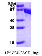Human DDC / DOPA Decarboxylase Protein (Recombinant His)