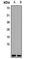 Polyclonal Rabbit anti-Human UBC / Ubiquitin C Antibody (IHC, WB)