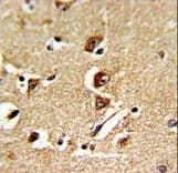 Polyclonal Rabbit anti-Human GNPAT / DHAP-AT Antibody (aa654-680, IHC, WB)