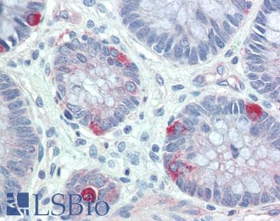 IHC-plus™ Polyclonal Rabbit anti-Human FER Antibody (IHC, WB)