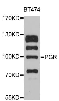 PR / Progesterone Receptor Antibody