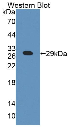 CHN2 / Chimerin 2 Antibody (aa101-323, FITC)