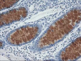 AP50 / AP2M1 Antibody (clone OTI 2F11)