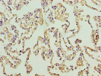 PRDM14 Antibody