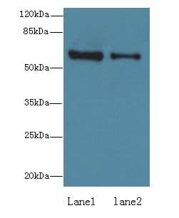 ZNF626 Antibody