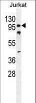 CWC22 Antibody (aa16-45)