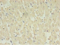 STRADB / ALS2CR2 Antibody