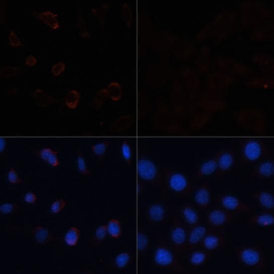 Acetyl-CoA Carboxylase / ACC Antibody