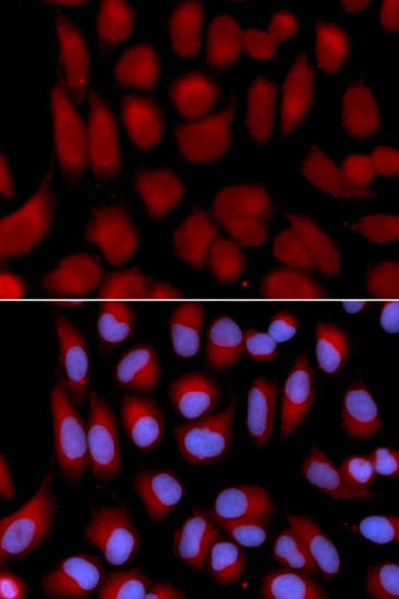 IHC-plus™ Polyclonal Rabbit anti-Human TAP2 Antibody (IHC, IF, WB)