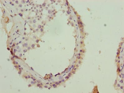 GOSR2 / Membrin Antibody (aa1-190)