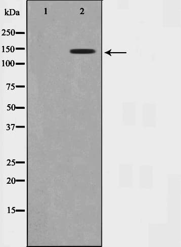 SMC1A / SMC1 Antibody (phospho-Ser957)