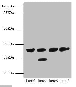 Polyclonal Rabbit anti-Human PSME1 Antibody (IHC, WB)