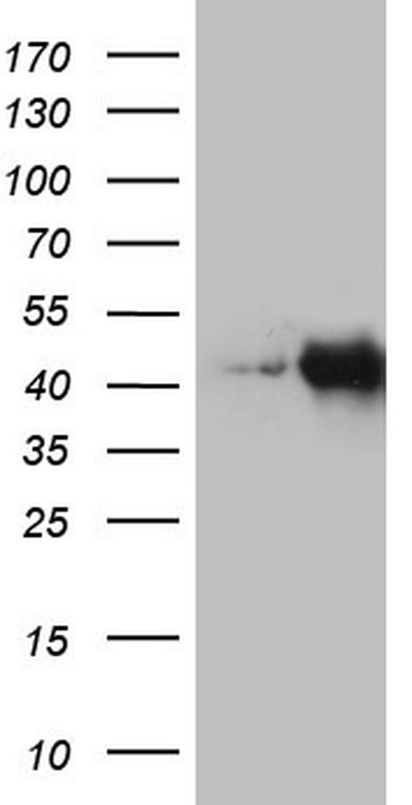 Monoclonal Mouse anti-Human KRT19 / CK19 / Cytokeratin 19 Antibody (clone OTI8A11, aa240-390, WB)