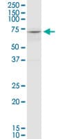 COL8A2 / Collagen VIII Antibody (clone 1F4)