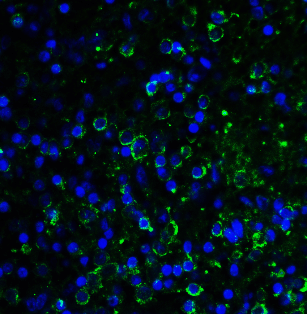 LAG3 Antibody (clone 1G4)