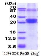 Human RNF114 / ZNF313 Protein (Recombinant His)