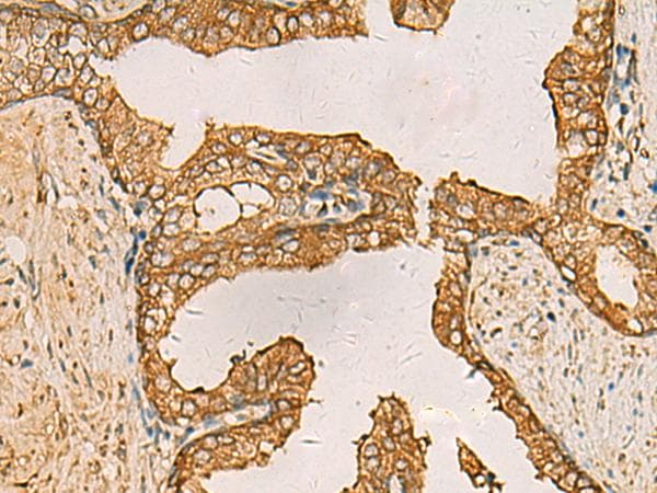 AIMP1 / EMAP II Antibody