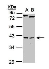 Polyclonal Rabbit anti-Human NKX2-5 Antibody (aa1-218, WB)