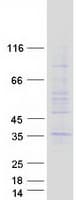 Human TMEM38A Protein (Recombinant Myc-DDK (Flag))