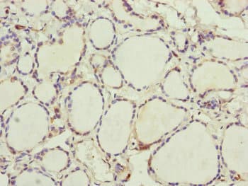 Polyclonal Rabbit anti-Human UXT Antibody (IHC)