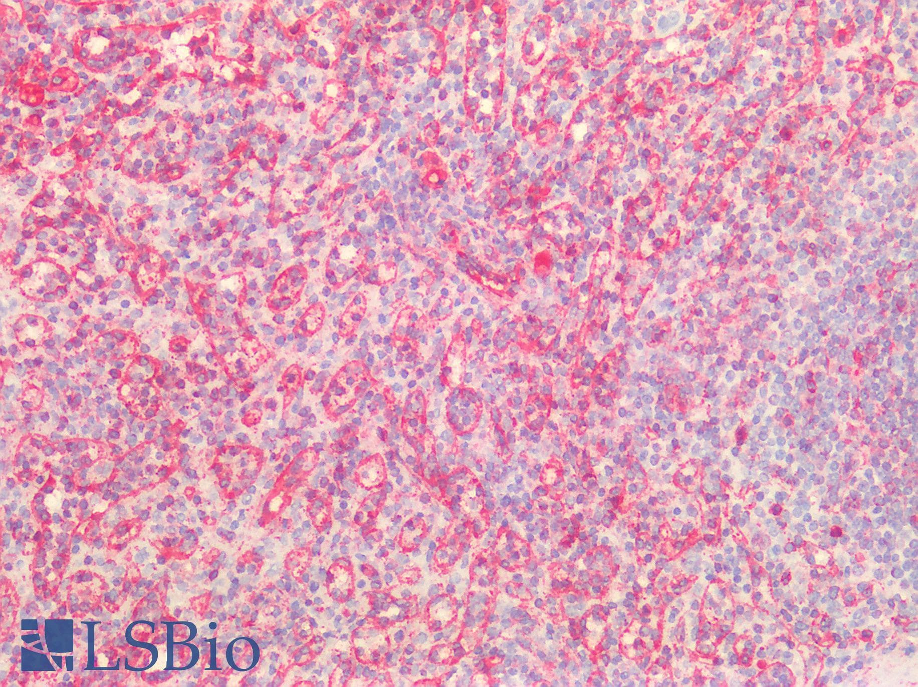IHC-plus™ Polyclonal Rabbit anti-Human Vimentin Antibody (IHC, IF, WB)