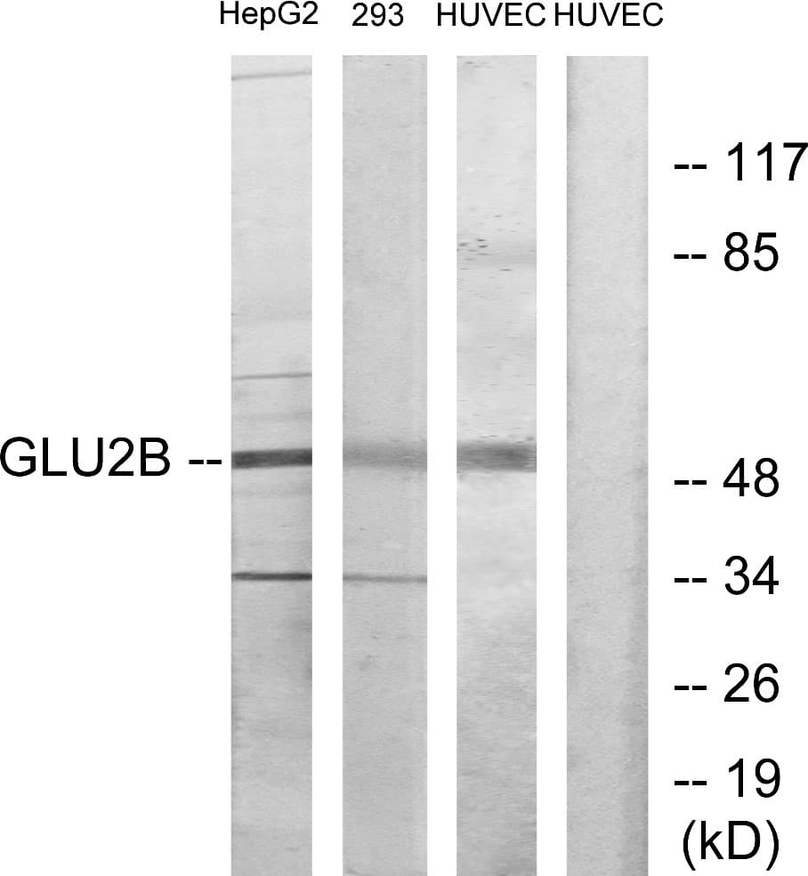 PRKCSH Antibody (aa81-130)